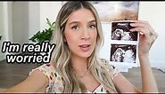 GOOD NEWS + BAD NEWS ANATOMY ULTRASOUND (19 weeks pregnancy update) | leighannvlogs