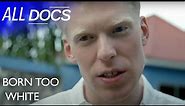 What It's Like To Have Albinism in Tanzania | Full Documentary | All Documentary