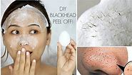 DIY Blackhead Peel Off Mask with an Egg | It Actually WORKS!