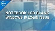 How to Fix Black Screen on Dell Laptop (Official Dell Tech Support)