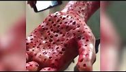 Do You Have Trypophobia: The Fear of Holes? | The Doctors