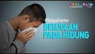 Fakta Benjolan Pada Hidung, Begini Penjelasannya