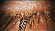 Warning: Eyelash extensions could bring tiny mites