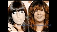 Cher Plastic Surgery Before and After