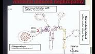 HIV Associated Nephropathy - Medical PowerPoint Presentation