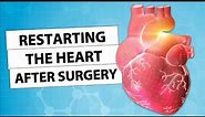 Surgeon Q&A: Restarting the Heart After Cardiac Surgery