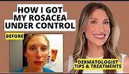 My Rosacea Journey: Dermatologist Shares Skincare & Treatments That Work! | Dr. Sam Ellis