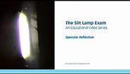 The Slit Lamp Exam – Episode 7, Specular Reflection