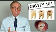 What Causes Tooth Decay? Cavity 101 | Causes | Treatment