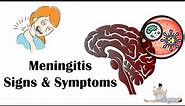 Meningitis - Signs & Symptoms |Most Common Signs & Symptoms Of Meningitis