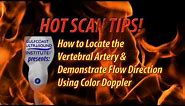 Hot Tip-How to Locate the Vertebral Artery and Demonstrate Flow Direction