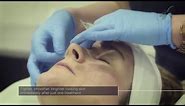 Skin Peel Obagi Blue Peel Radiance at The Laser and Skin Clinic