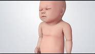 Infant Distress Warning Signs (Grunting Baby Sound)