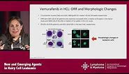 Hairy Cell Leukemia: Efficacy and Safety of Current Treatment Options