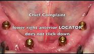NEW! Locator Dental Implant Attachments - Workshop Tips