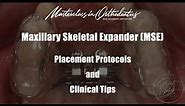 Maxillary Skeletal Expander | MSE | Jaw Expansion | Placement Procedure | Clinical Protocol and Tips