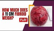 How Much does a 11 CM Fibroid Weigh? [Must-Watch]