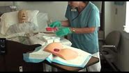 Wound Packing