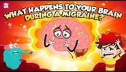 What Is a Migraine Headache? | What Happens to Your Brain During a Migraine? | The Dr Binocs Show