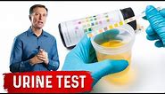 Urine Test Simplified