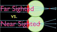 Farsighteness vs. Nearsightedness, An Explanation