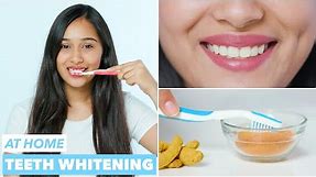 Easy Teeth Whitening at Home