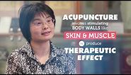 How does acupuncture work? | RMIT University