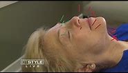 Facial Rejuvenation Acupuncture: A Natural Way to Get Rid of Wrinkles
