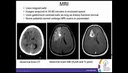 Understanding the Radiology Report to Diagnose, Treat and Monitor Brain Tumors