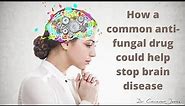 How an common anti-fungal drug could help stop brain disease