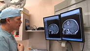 Brain Surgery with Dr. Mark Matishak - 02 MRI scan with tumour