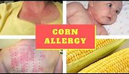 Corn allergy Symptoms – Causes Symptoms and Pictures of Corn allergy Skin Rash in Kids Adults
