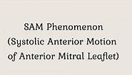 SAM Phenomenon (Systolic anterior motion of anterior mitral valve leaflet)