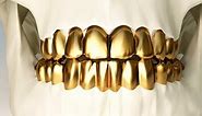 ✨ Permanent Gold Teeth Guide: Implants, Crowns, & Grillz - Dentaly.org