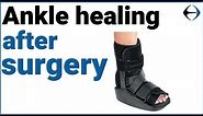 Ankle Surgery: How long does it take for your ankle to heal after surgery?