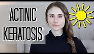 Actinic keratosis removal, treatments, and prevention| Dr Dray