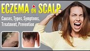 Eczema on Scalp Causes, Types, Symptoms, Treatment and Prevention | Scalp Dermatitis dandruff