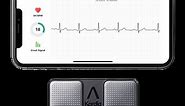 KardiaMobile EKG Monitor - Instant EKG on Your Phone | AliveCor