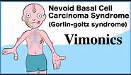 Nevoid Basal Cell Carcinoma Syndrome (Gorlin-goltz syndrome): Visual mnemonics