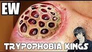 UhOhBro's Photos that Trigger Trypophobia Fear of Holes (Discussion)