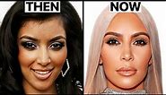 Kim Kardashian's New Face | Plastic Surgery Analysis