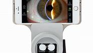 iON Slit Lamp Imaging System » Marco Healthcare