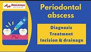 Periodontal abscess (Part 2) - Diagnosis and Treatment l Incision and drainage l Mediklaas