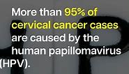 HPV and cervical cancer