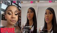 Cardi B talks about plastic surgery she had on her face gives advices on plastic surgery etc
