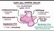 Germ cell ovarian tumors