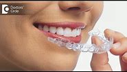 How do Invisible Braces work? - Dr Girish P V