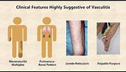Vasculitis - An Overview