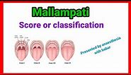 Mallampati classification | airway assessment | detail presentation | @anaesthesiawithbabar2576