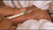 Newborn Care Series: Giving an Intradermal Injection